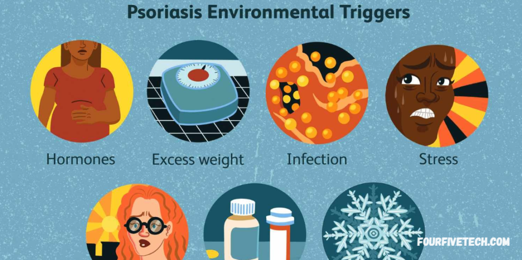 How Does Psoriasis Progress