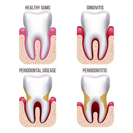 How General Dentistry Tracks Gum And Bone Health Over Time