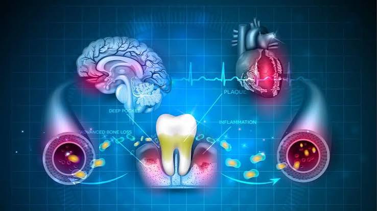 Why Oral Systemic Health Connections Matter In General Dentistry